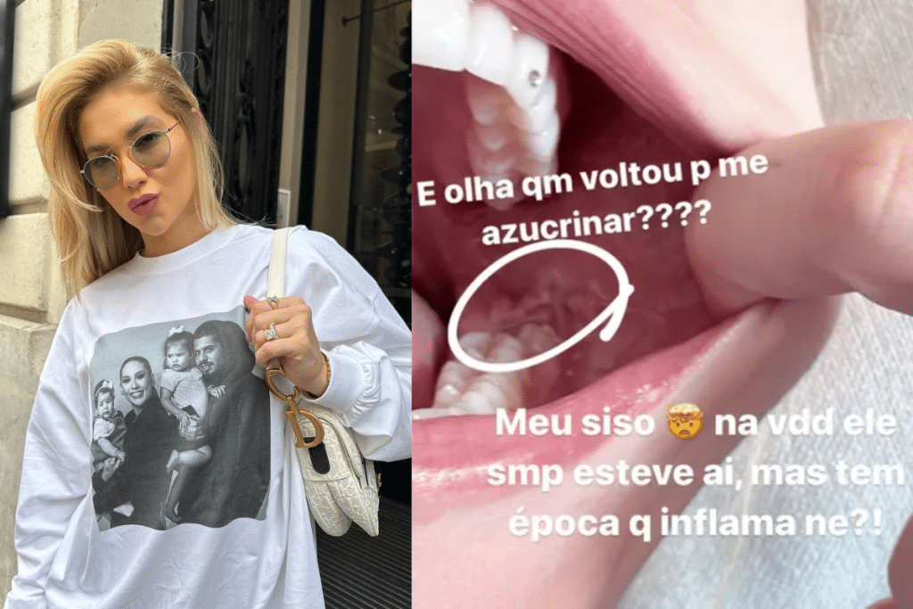 Virginia explicou que um dos seus sisos voltou a inflamar, o que vem lhe causando fortes e constantes enxaquecas. (Fotos: Reprodução / Instagram)